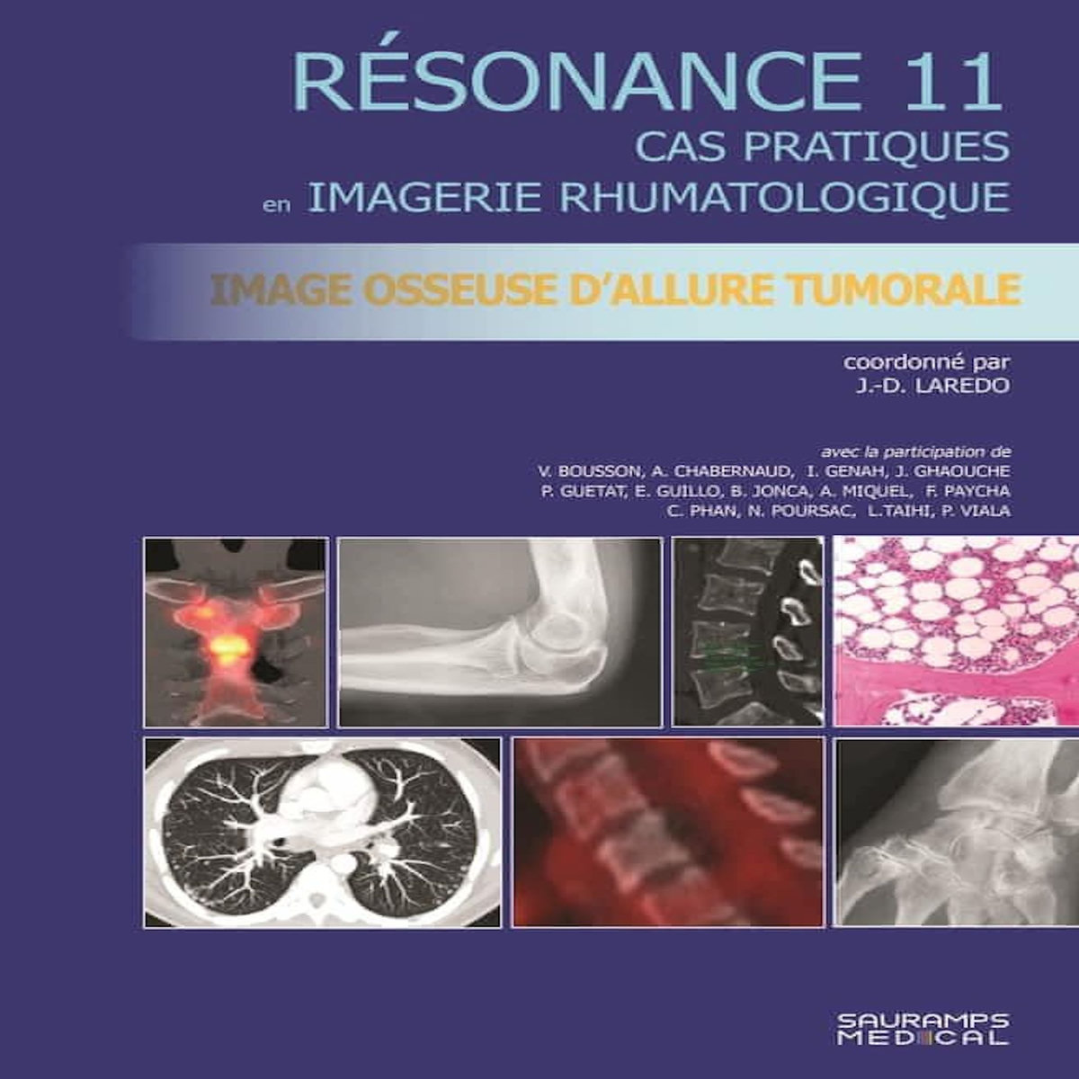 IMAGERIE OSSEUSE D'ALLURE TUMORALE. CAS PRATIQUES EN IMAGERIE MUSCULOSQUELETTIQUE, Laredo Jean-Denis