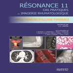 IMAGERIE OSSEUSE D'ALLURE TUMORALE. CAS PRATIQUES EN IMAGERIE MUSCULOSQUELETTIQUE, Laredo Jean-Denis