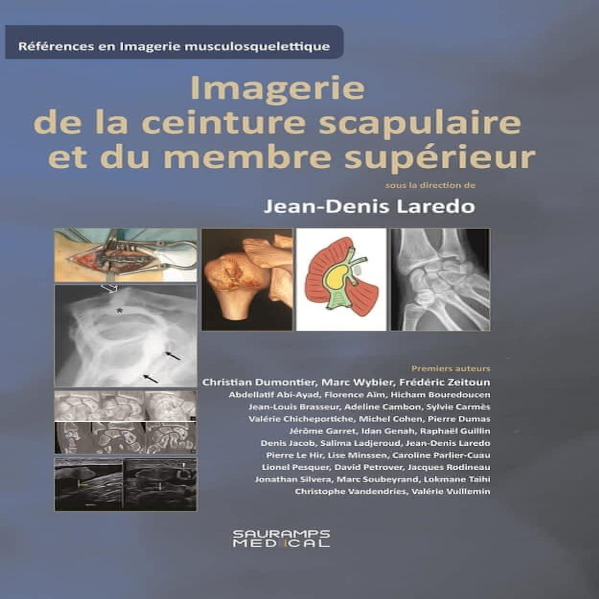 IMAGERIE DE LA CEINTURE SCRAPULAIRE ET DU MEMBRE SUPERIEUR, Laredo Jean-Denis