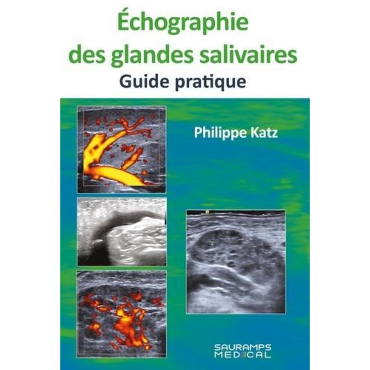 ECHOGRAGIE DES GLANDES SALIVAIRES. GUIDE PRATIQUE, Katz Philippe