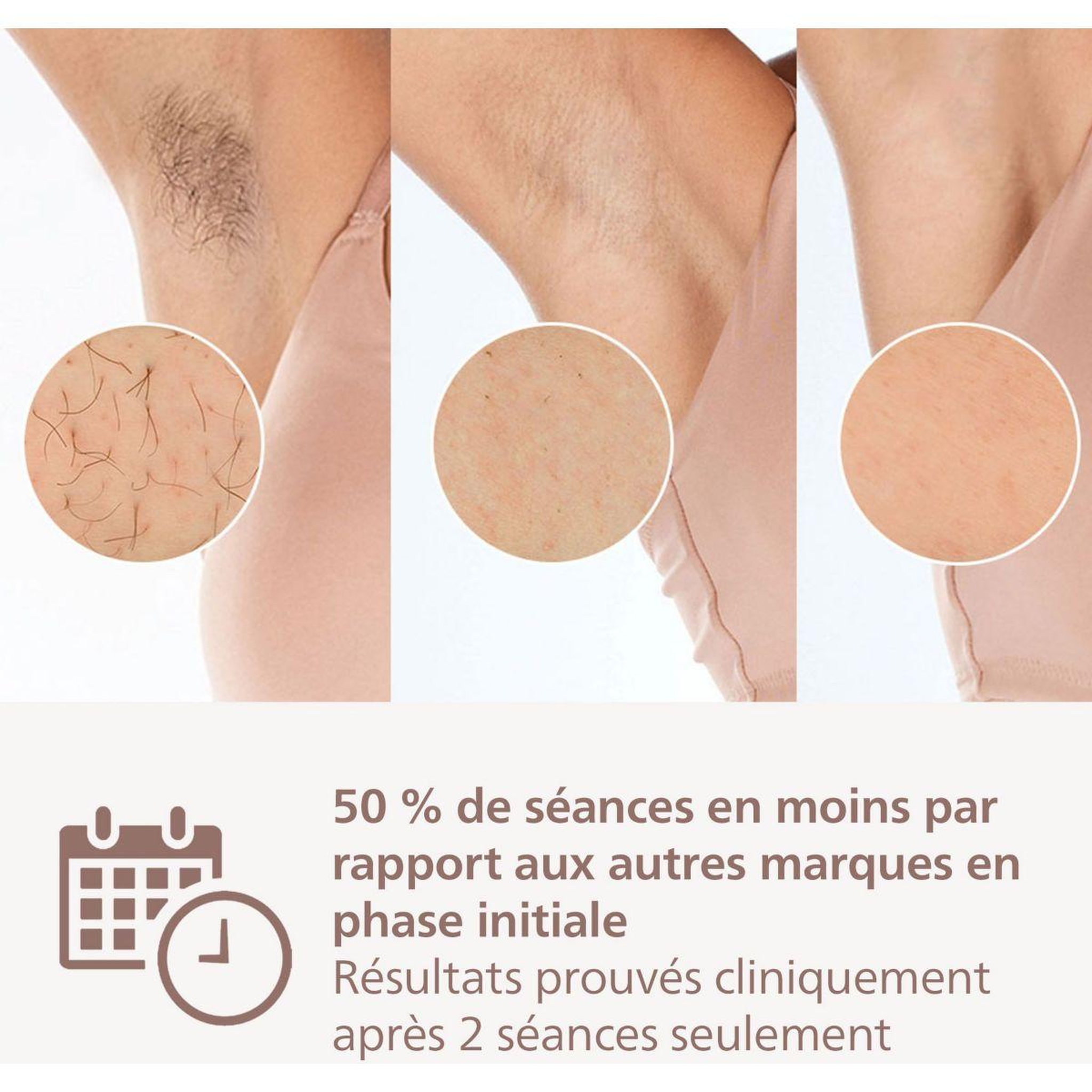 Voir la diapositive 5 : Philips Epilateur lumière pulsée lumea série 7000 bri920/00