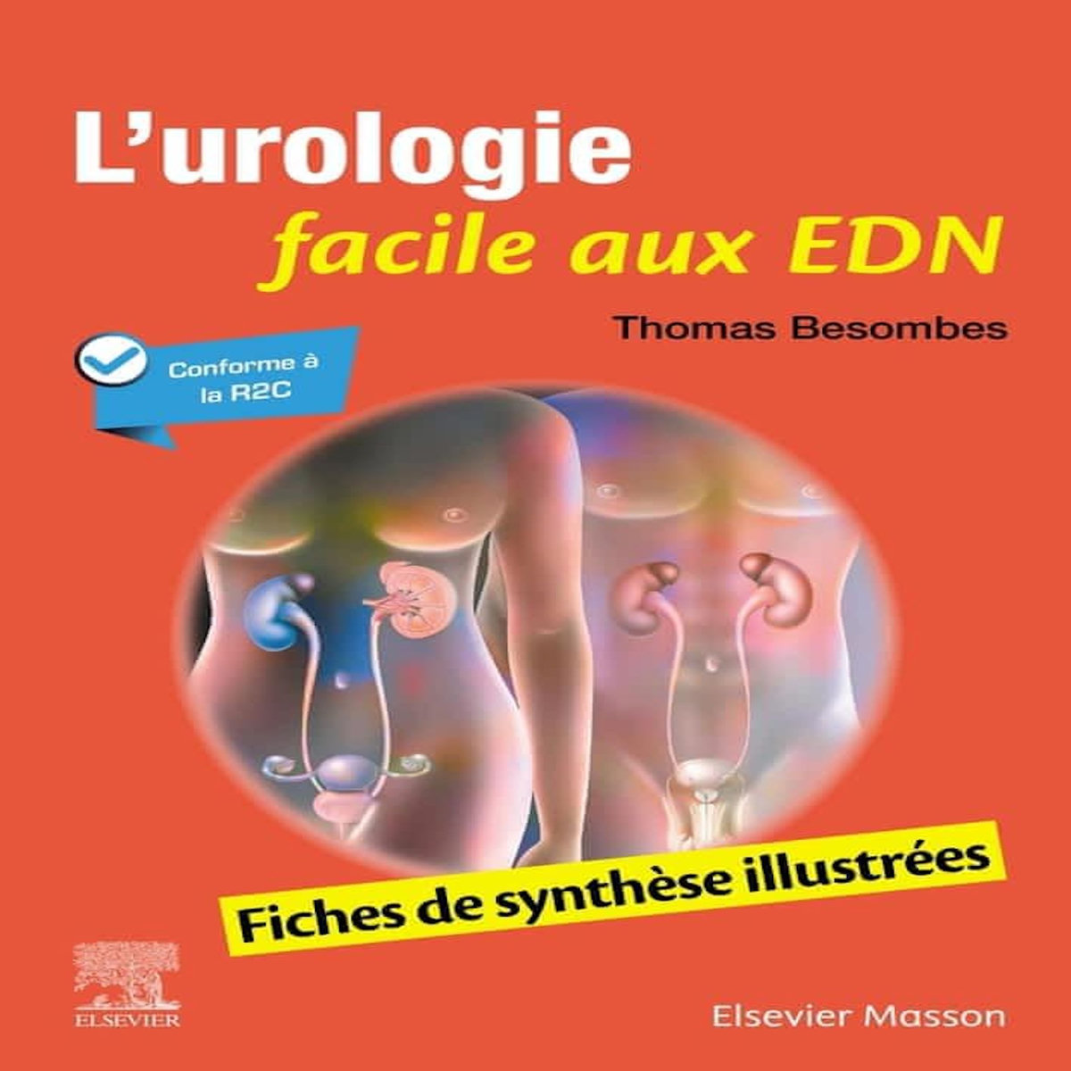 L'UROLOGIE FACILE AUX EDN. FICHES DE SYNTHESE ILLUSTREES, Besombes Thomas