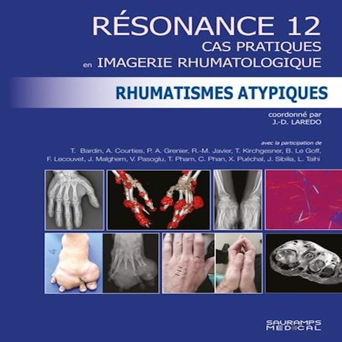 RESONANCE. TOME 12, RHUMATISMES ATYPIQUES. CAS PRATIQUES EN IMAGERIE RHUMATOLOGIQUE, Laredo Jean-Denis