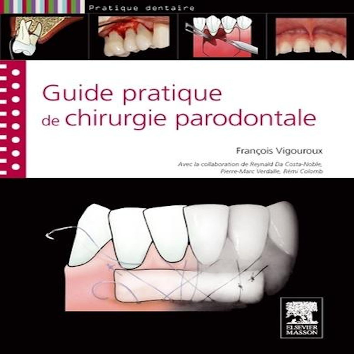 GUIDE PRATIQUE DE LA CHIRURGIE PARODONTALE, Vigouroux François