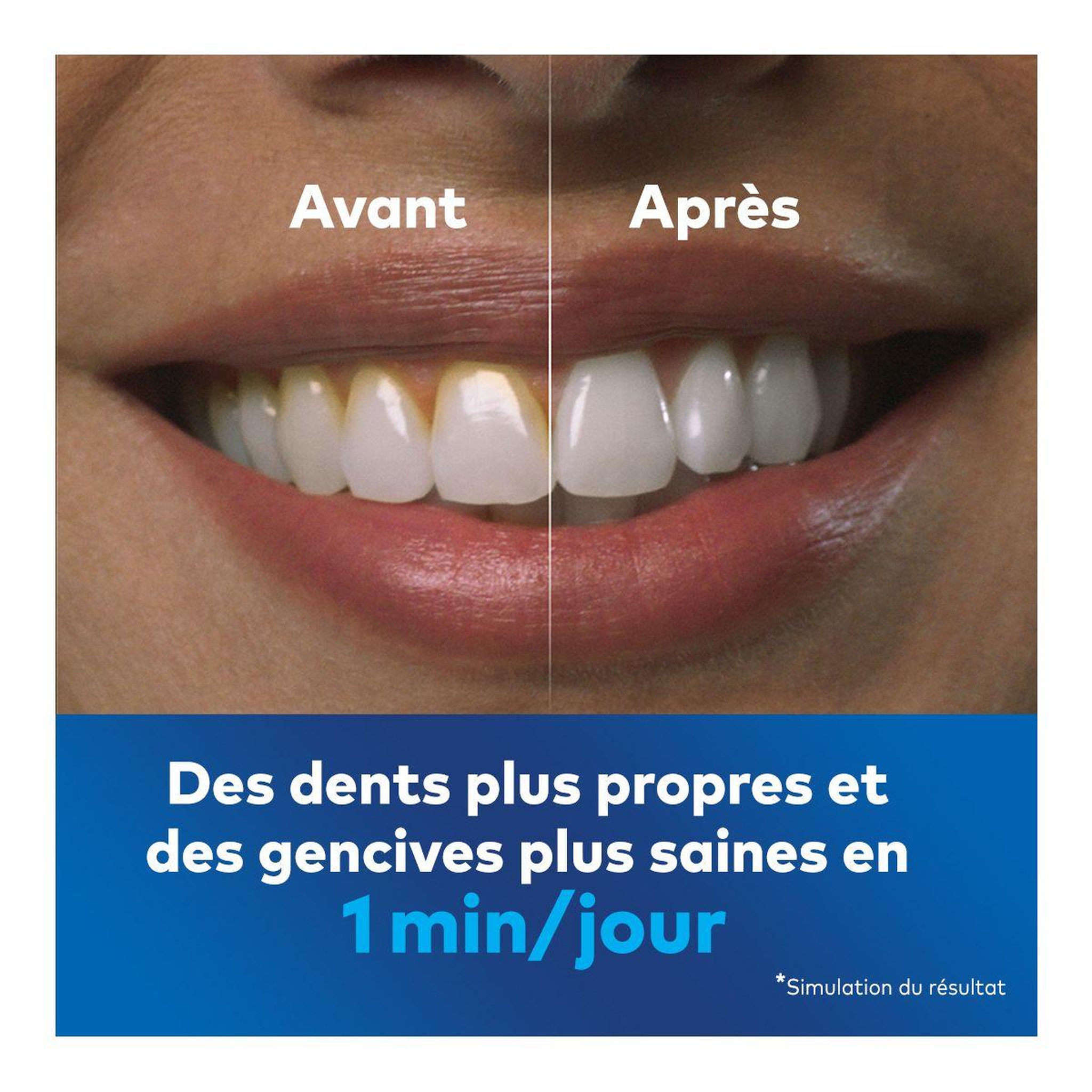 Voir la diapositive 4 : Waterpik Hydropulseur WF-10 Blanc