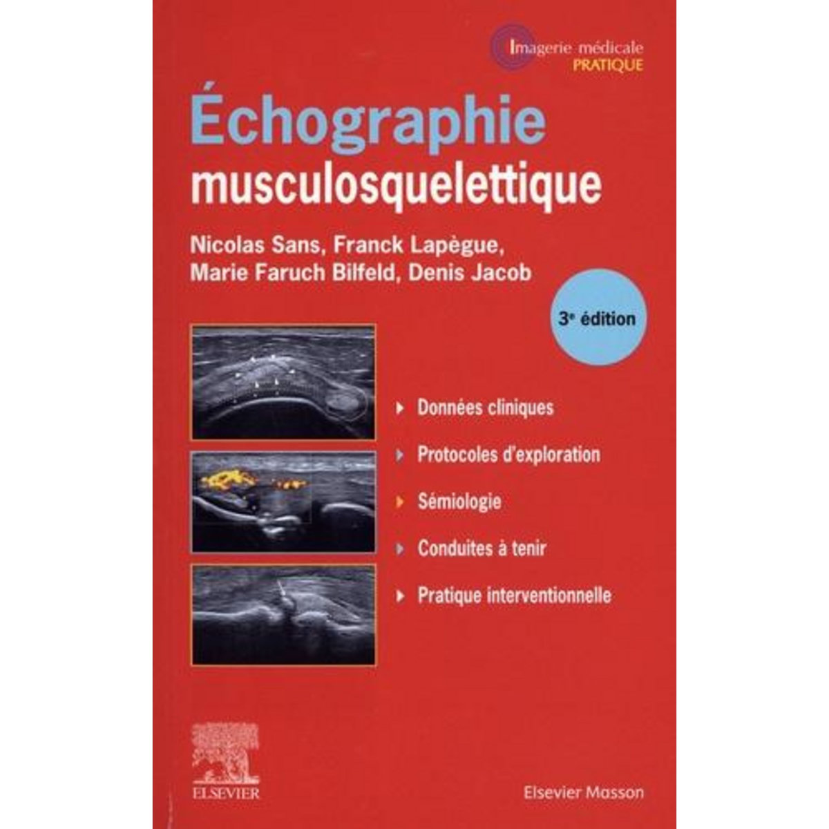 ECHOGRAPHIE MUSCULOSQUELETTIQUE. 3E EDITION, Sans Nicolas