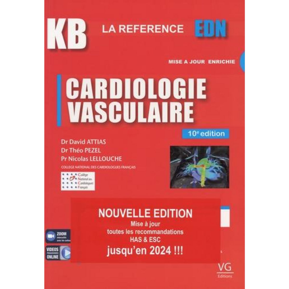 CARDIOLOGIE VASCULAIRE. PACK EN 2 VOLUMES AVEC LIVRET DE FICHES, EDITION 2024, Attias David