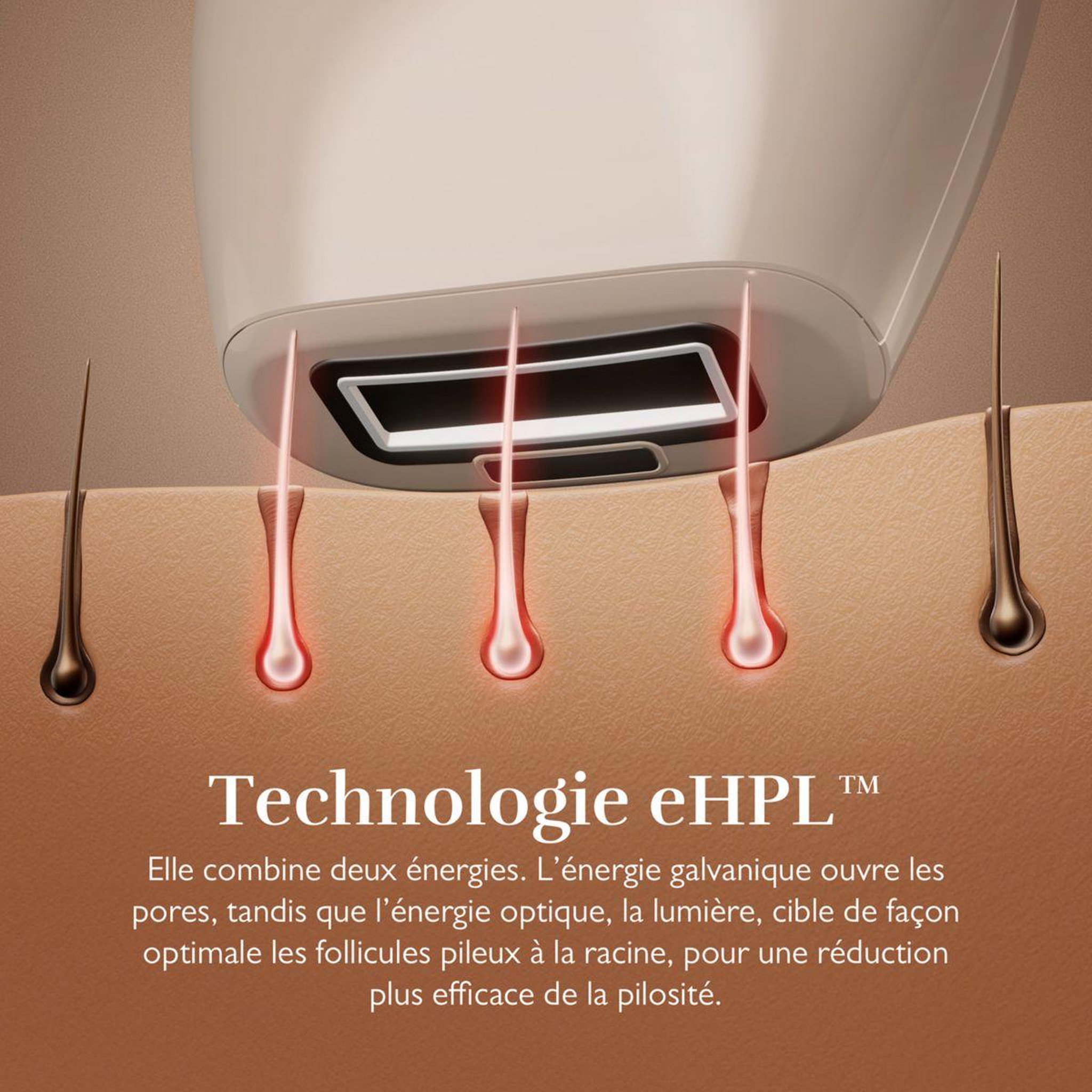 Voir la diapositive 5 : SILK'N Epilateur lumière pulsée Infinity fast