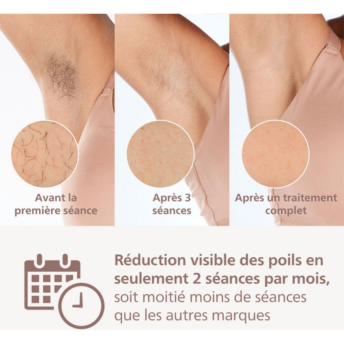 Philips Epilateur lumière pulsée IPL BRI958/00 Lumea Series 9000