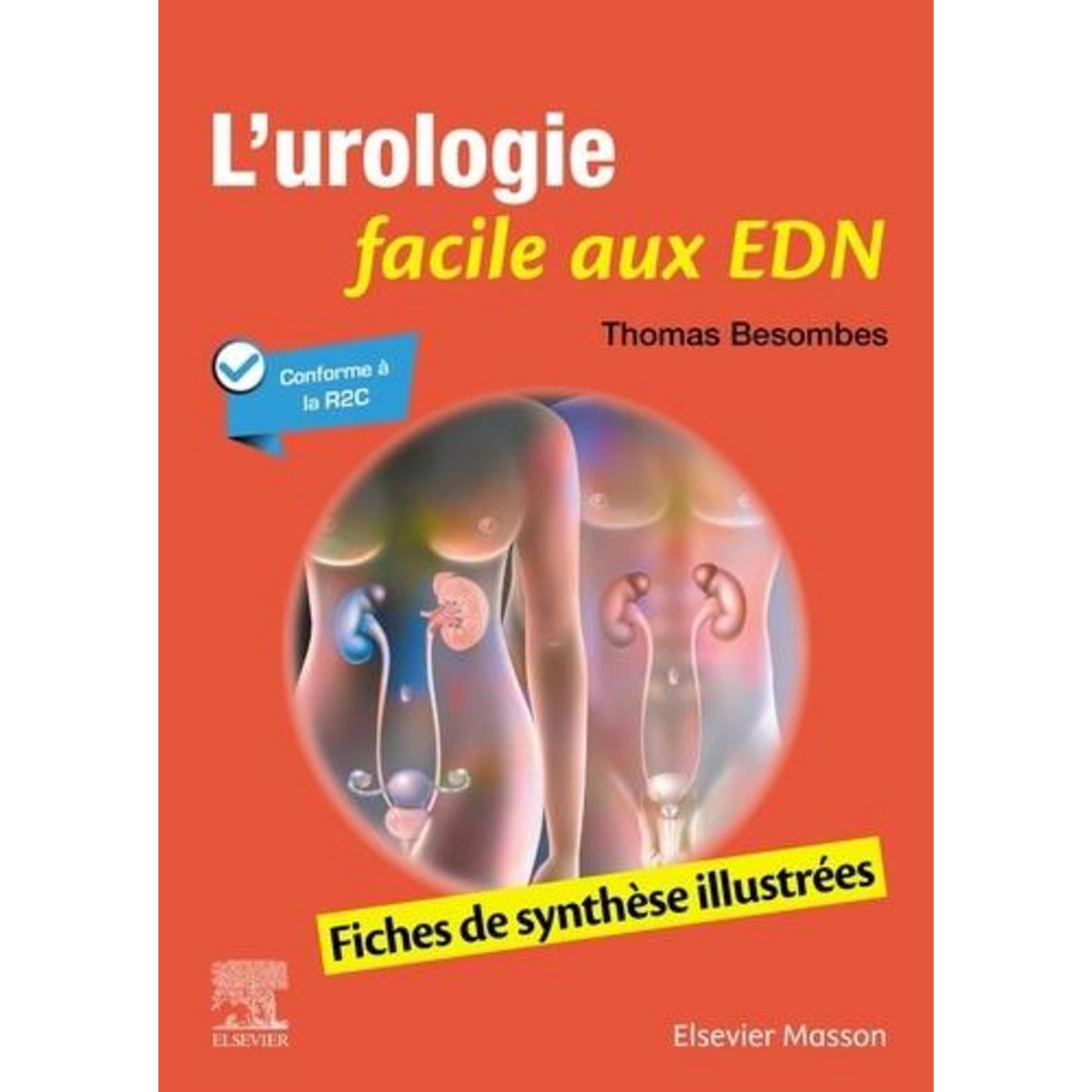 L'UROLOGIE FACILE AUX EDN. FICHES DE SYNTHESE ILLUSTREES, Besombes Thomas