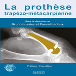 LA PROTHESE TRAPEZO-METACARPIENNE, Lussiez Bruno