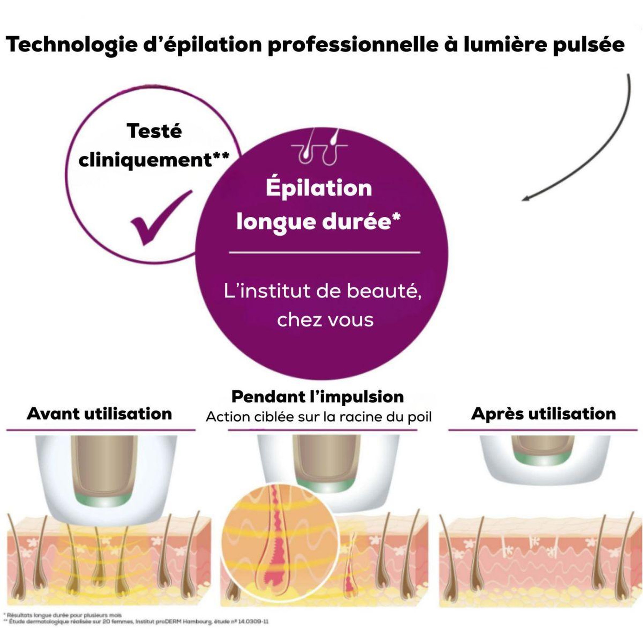 Voir la diapositive 3 : Beurer Epilateur lumière pulsée ipl 5800 - 600 000 flashs