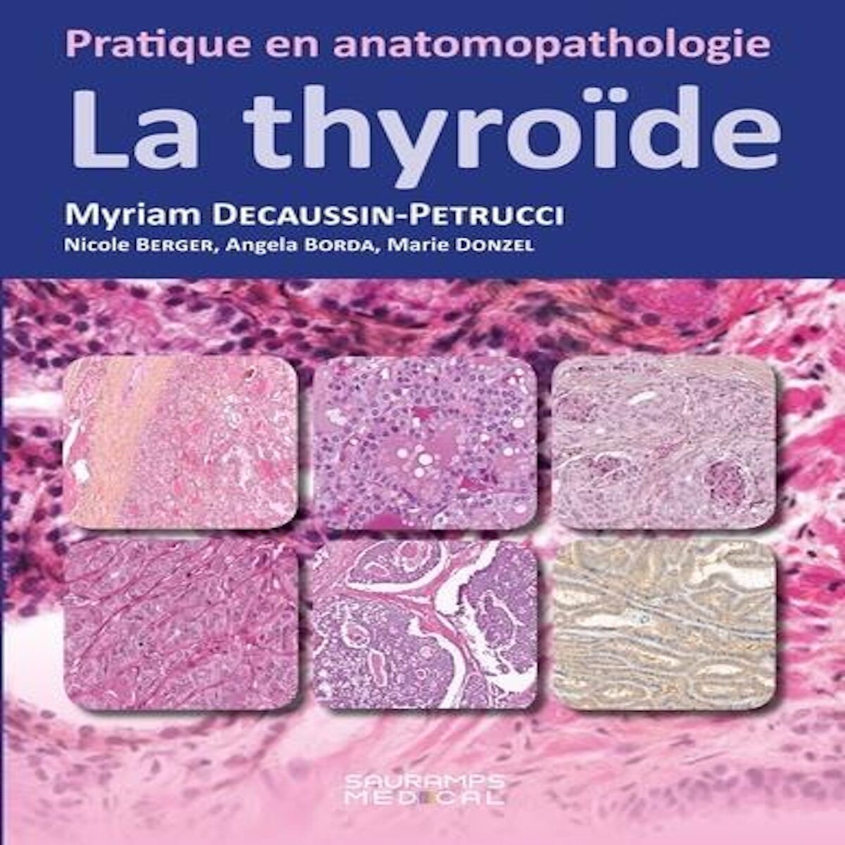 LA THYROIDE, Decaussin-Petrucci Myriam