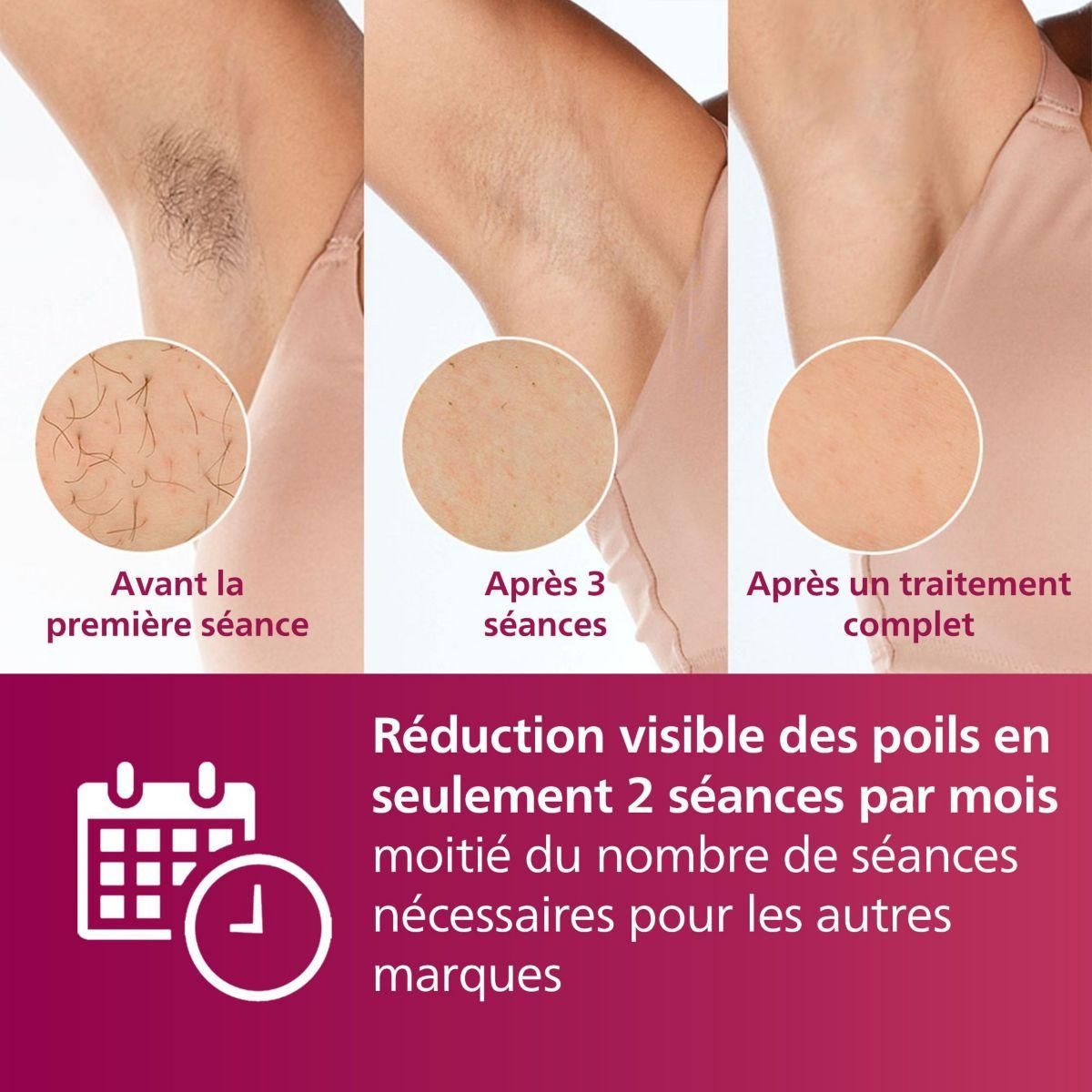 Philips Epilateur lumière pulsée IPL BRI920/00 series 7000