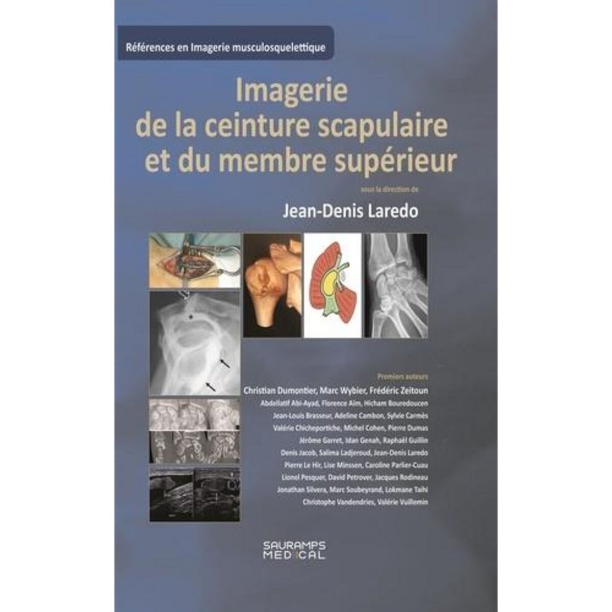 IMAGERIE DE LA CEINTURE SCRAPULAIRE ET DU MEMBRE SUPERIEUR, Laredo Jean-Denis