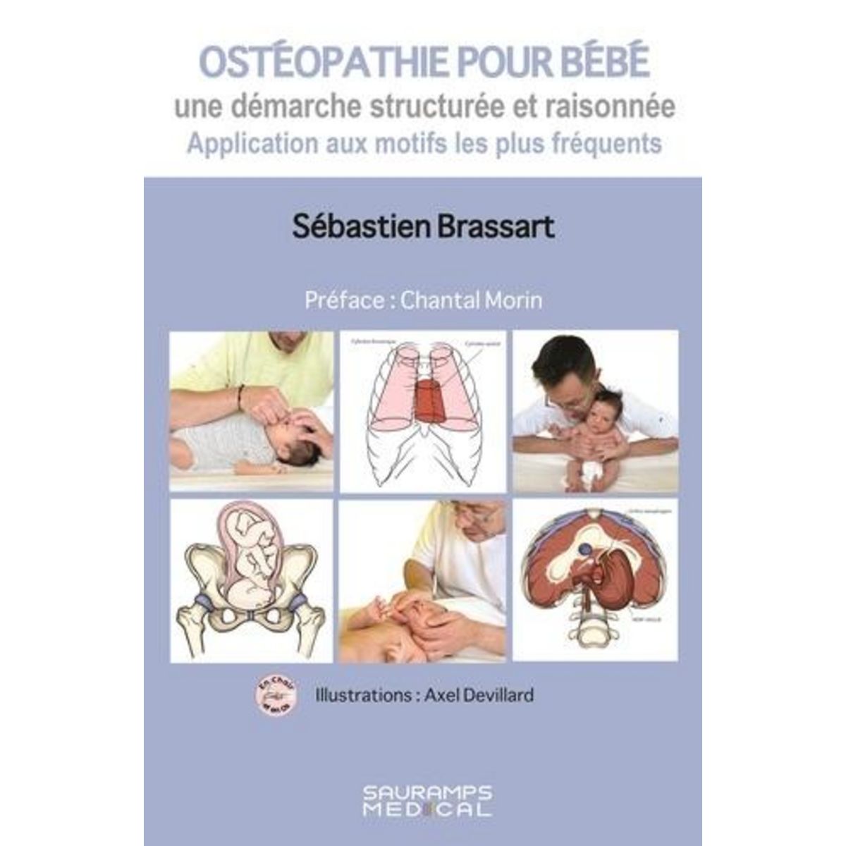 OSTEOPATHIE POUR BEBE. UNE DEMARCHE STRUCTUREE ET RAISONNEE, Brassart Sébastien