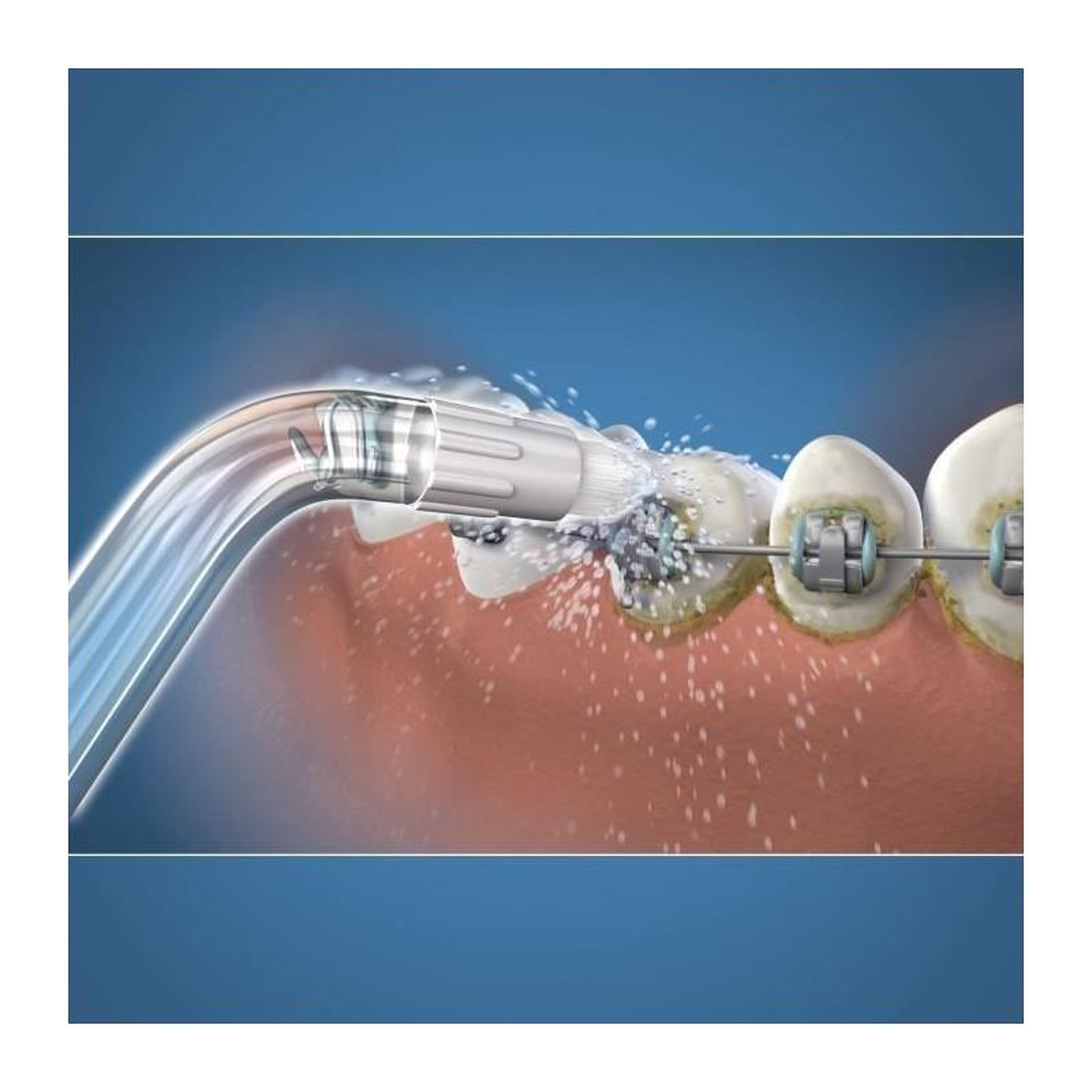 Voir la diapositive 2 : Waterpik Canule hydropulseur od-100e