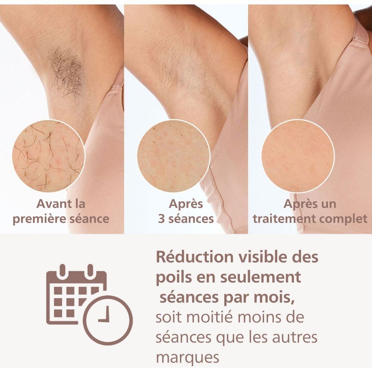 Philips Epilateur lumière pulsée Lumea série 9900 BRI951/01