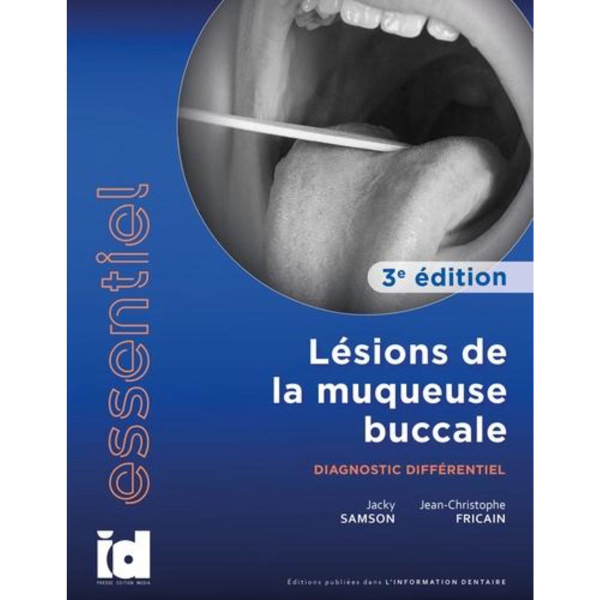 LESIONS DE LA MUQUEUSE BUCCALE. DIAGNOSTIC DIFFERENTIEL, 3E EDITION, Samson Jacky