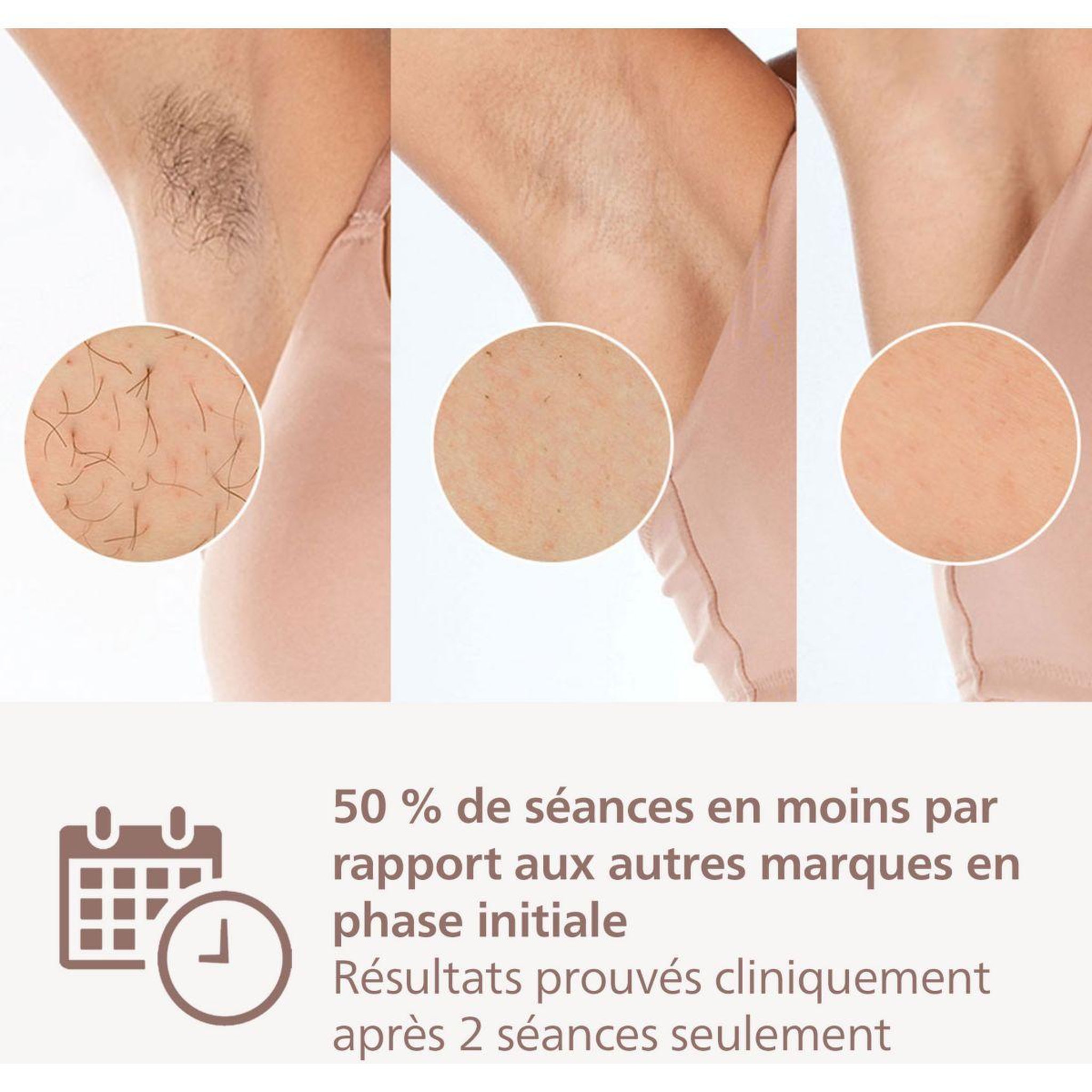 Voir la diapositive 5 : Philips Epilateur lumière pulsée lumea série 7000 bri920/00