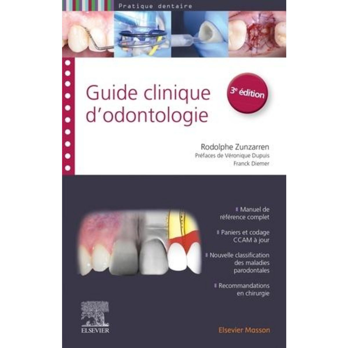 GUIDE CLINIQUE D'ODONTOLOGIE. 3E EDITION, Zunzarren Rodolphe