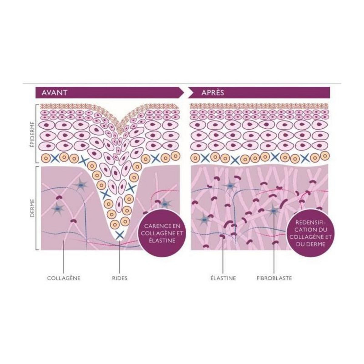 SILK'N Réductions des rides et raffermissement du visage - SILK'N Facetite Essentials - FTE1PE1R001