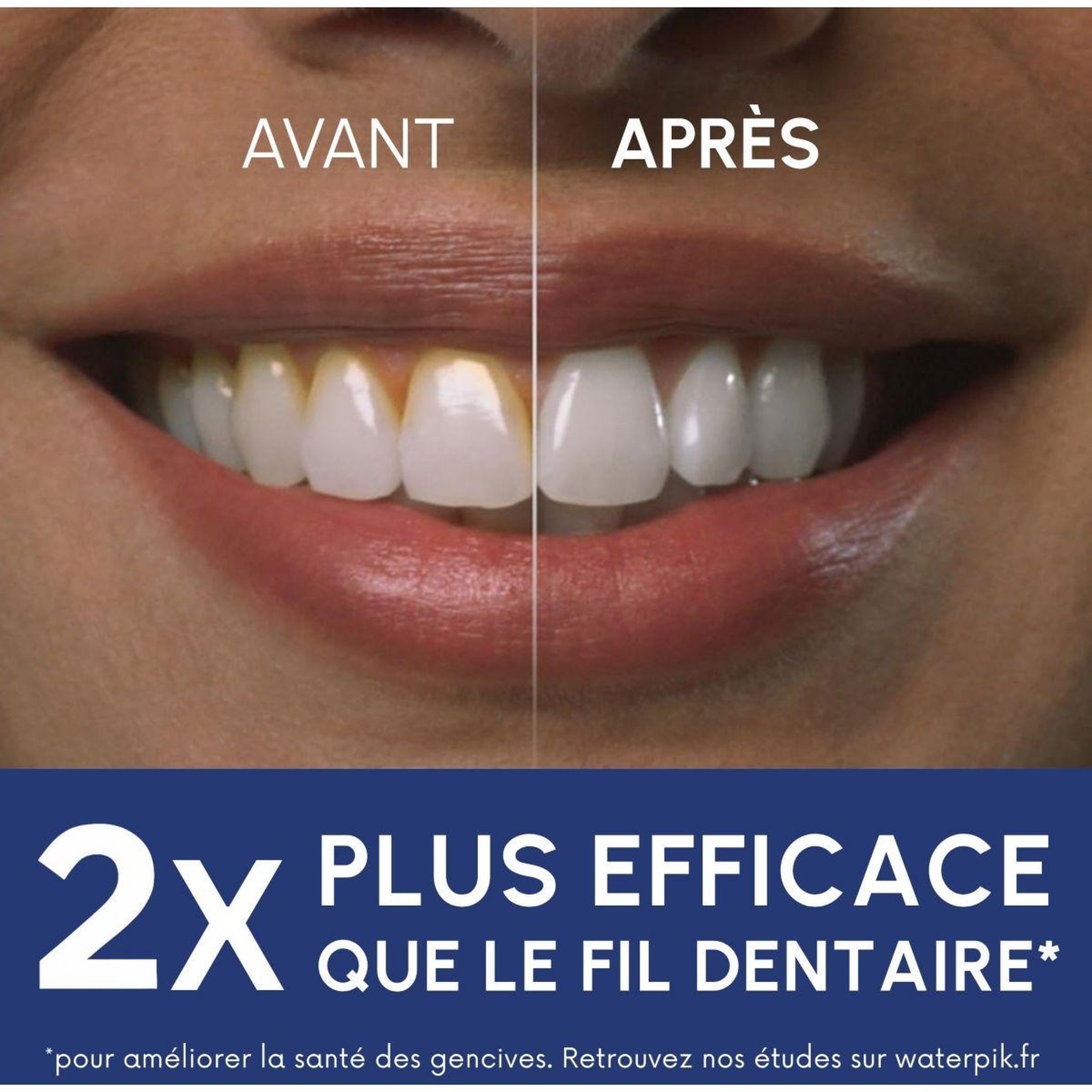 Voir la diapositive 4 : Waterpik Hydropulseur WF-150