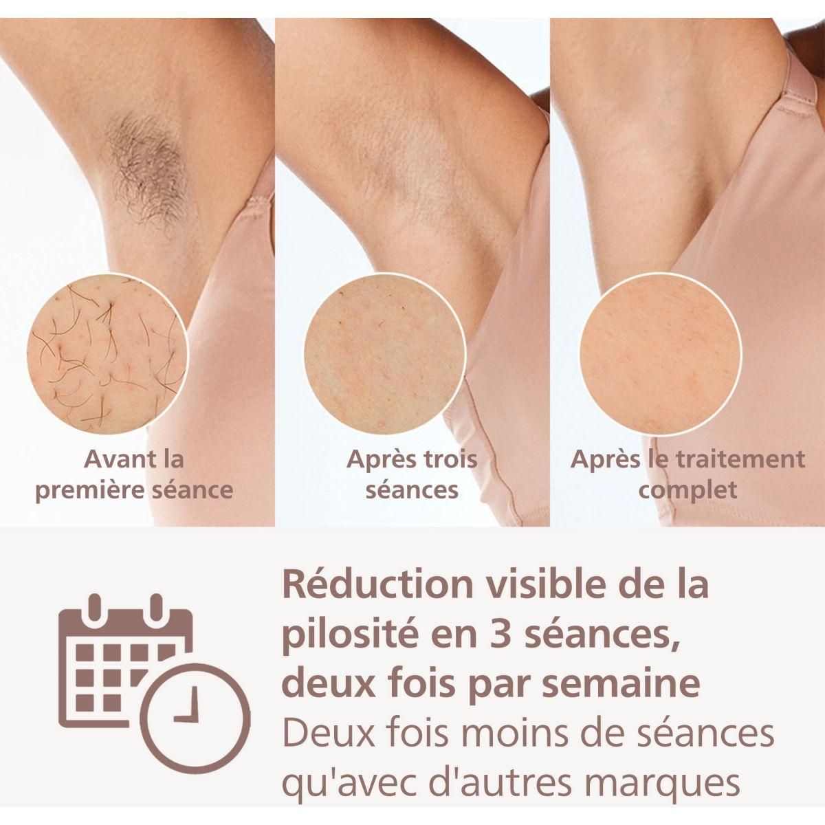 Philips Epilateur lumière pulsée BRI945/00 Lumea Prestige