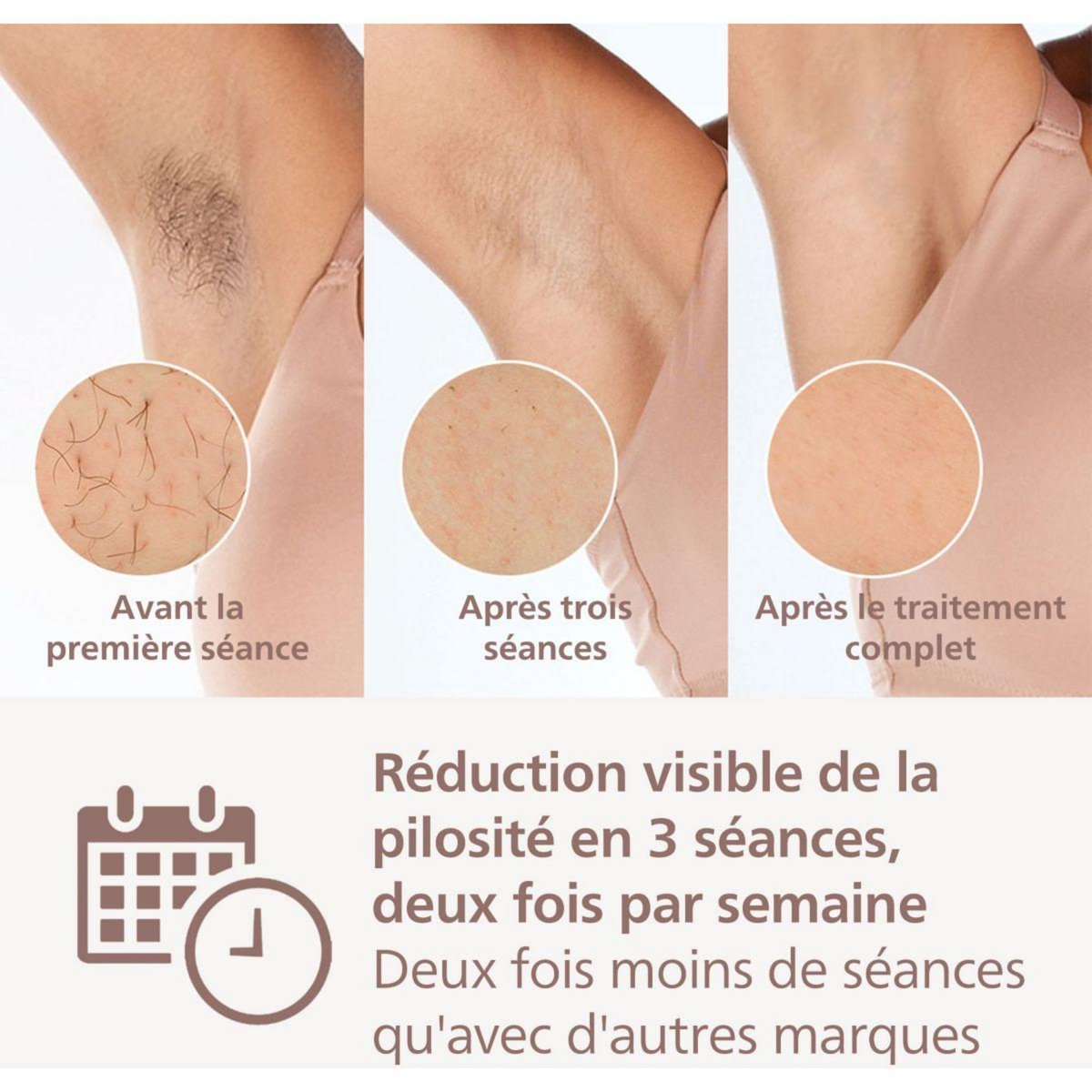 Philips Epilateur lumière pulsée BRI945/00 Lumea Prestige