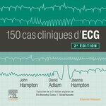 150 CAS CLINIQUES D'ECG. 2E EDITION, Hampton John R.