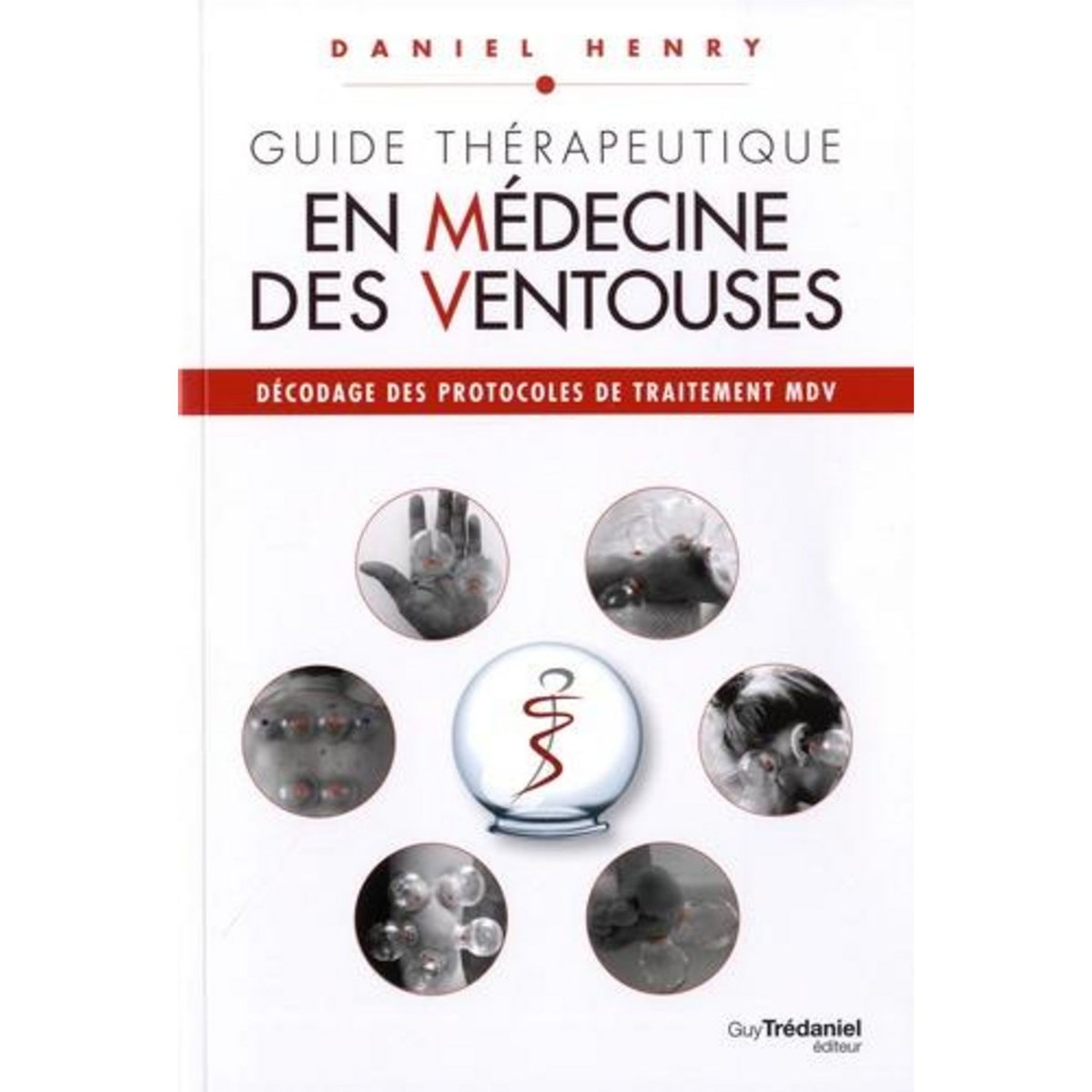 GUIDE THERAPEUTIQUE EN MEDECINE DES VENTOUSES. DECODAGE DES PROTOCOLES DE TRAITEMENT MDV, Henry Daniel