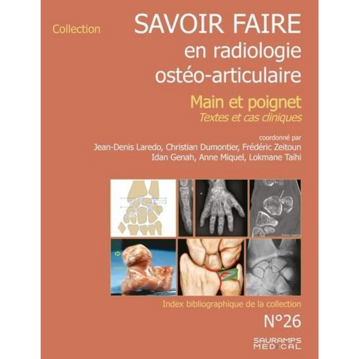 SAVOIR-FARIE EN RADIOLOGIE OSTEO-ARTICULAIRE. MAIN ET POIGNET. TEXTES ET CAS CLINIQUES, Laredo Jean-Denis
