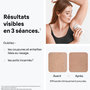 Voir la diapositive 3 : BRAUN Epilateur lumière pulsée IPL PL1124 Silk-expert Mini, 1 tête, 1 rasoir gillette Venus, 1 pochette