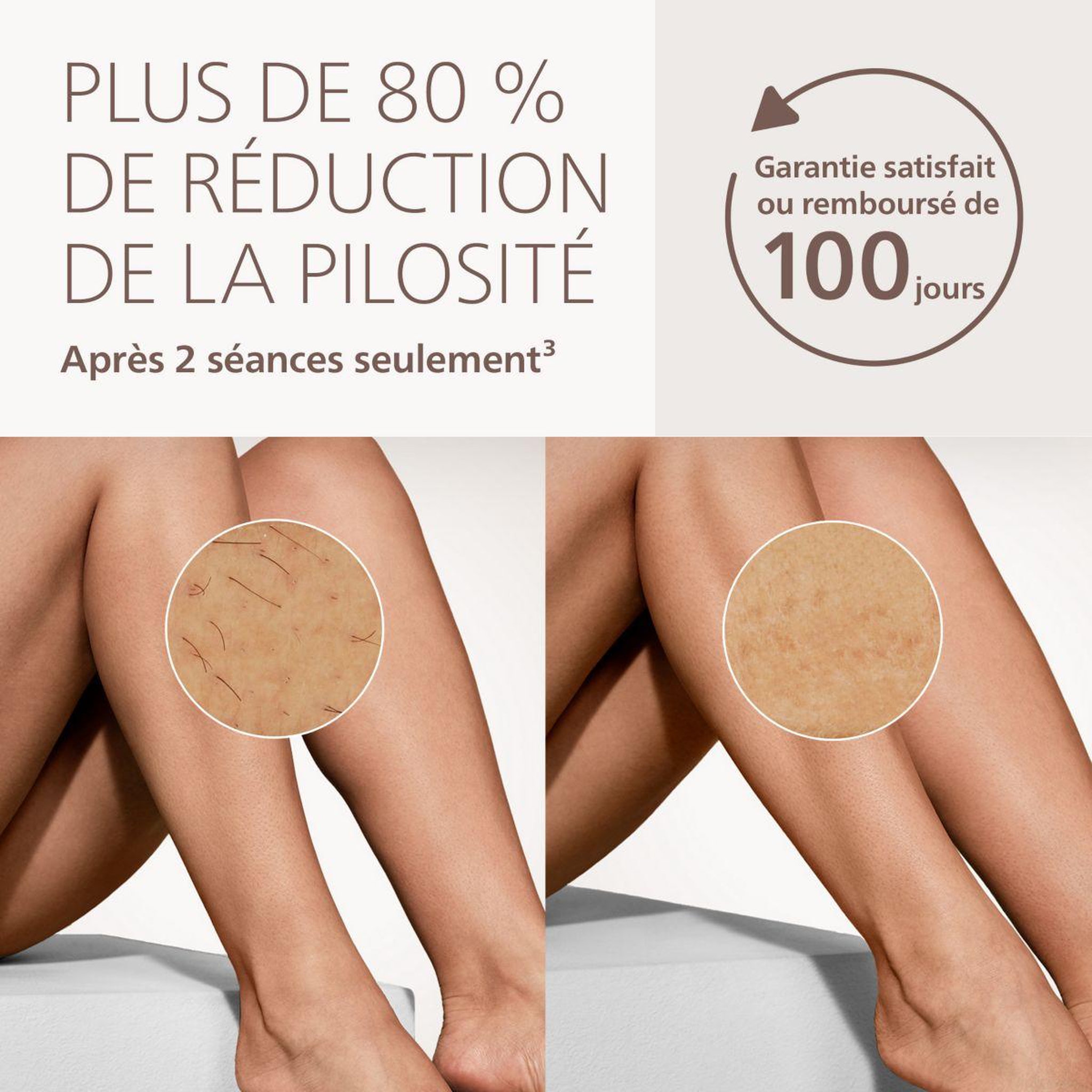 Voir la diapositive 4 : Philips Epilateur lumière pulsée Lumea Series 9000 BRI984/00