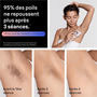 Voir la diapositive 5 : BRAUN Epilateur lumière pulsée IPL PL7211 Skin i-expert, 2 têtes, 1 rasoir Gillette Venus, 1 pochette