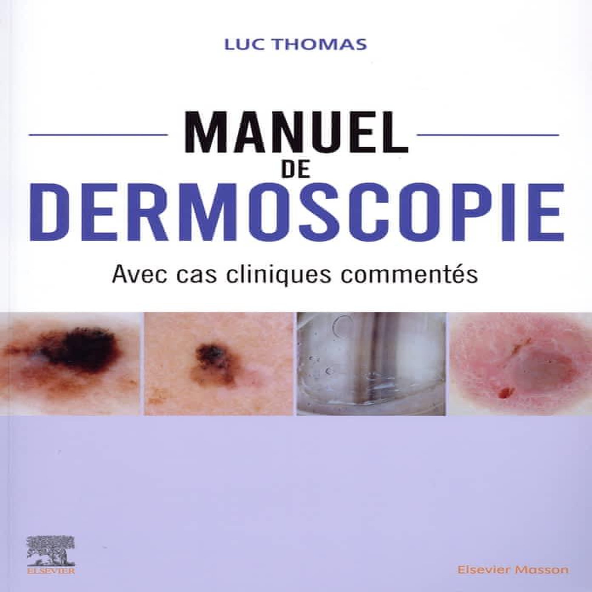 MANUEL DE DERMOSCOPIE. AVEC CAS CLINIQUES COMMENTES, Thomas Luc