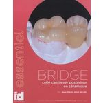 BRIDGE COLLE CANTILEVER POSTERIEUR EN CERAMIQUE, Attal Jean-Pierre