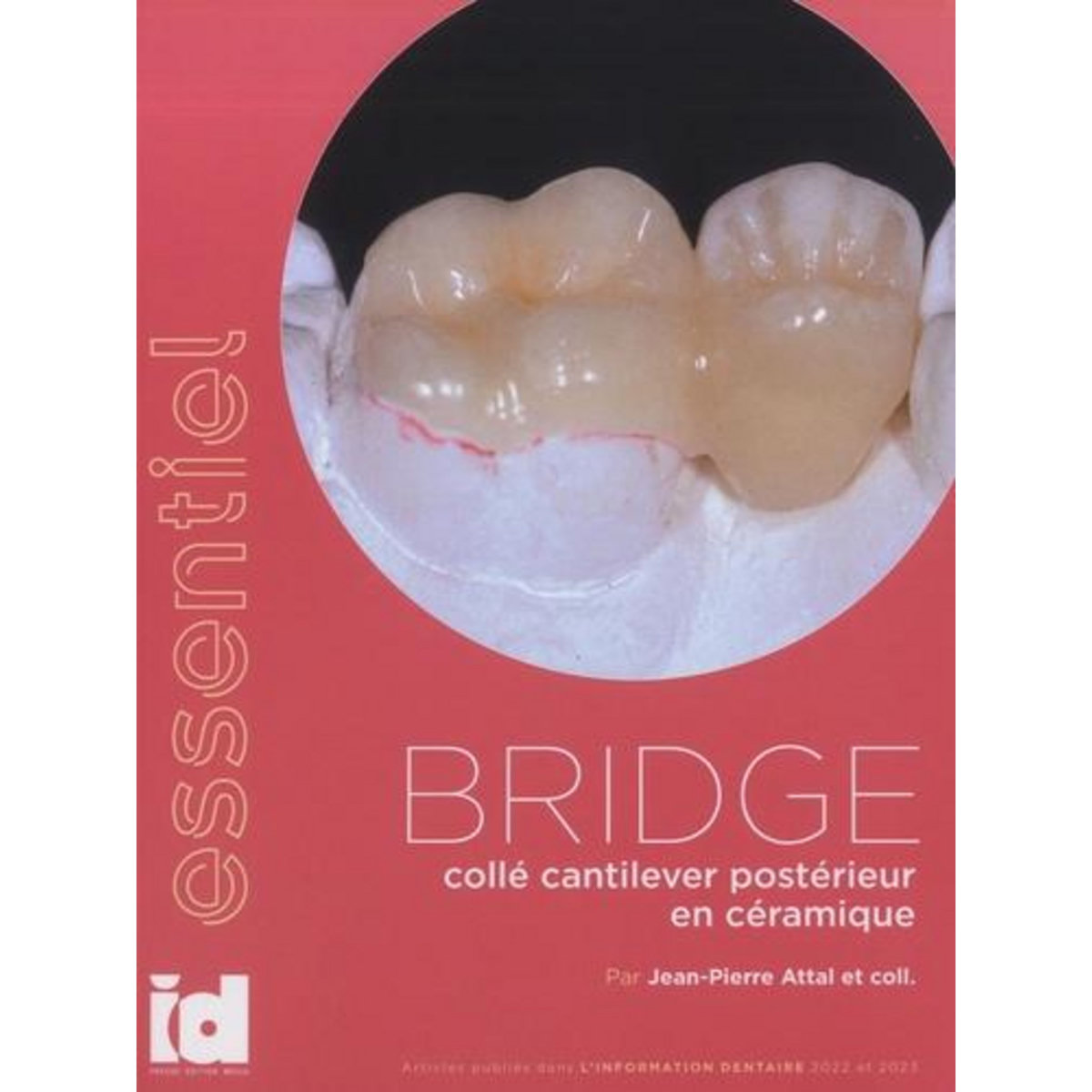 BRIDGE COLLE CANTILEVER POSTERIEUR EN CERAMIQUE, Attal Jean-Pierre