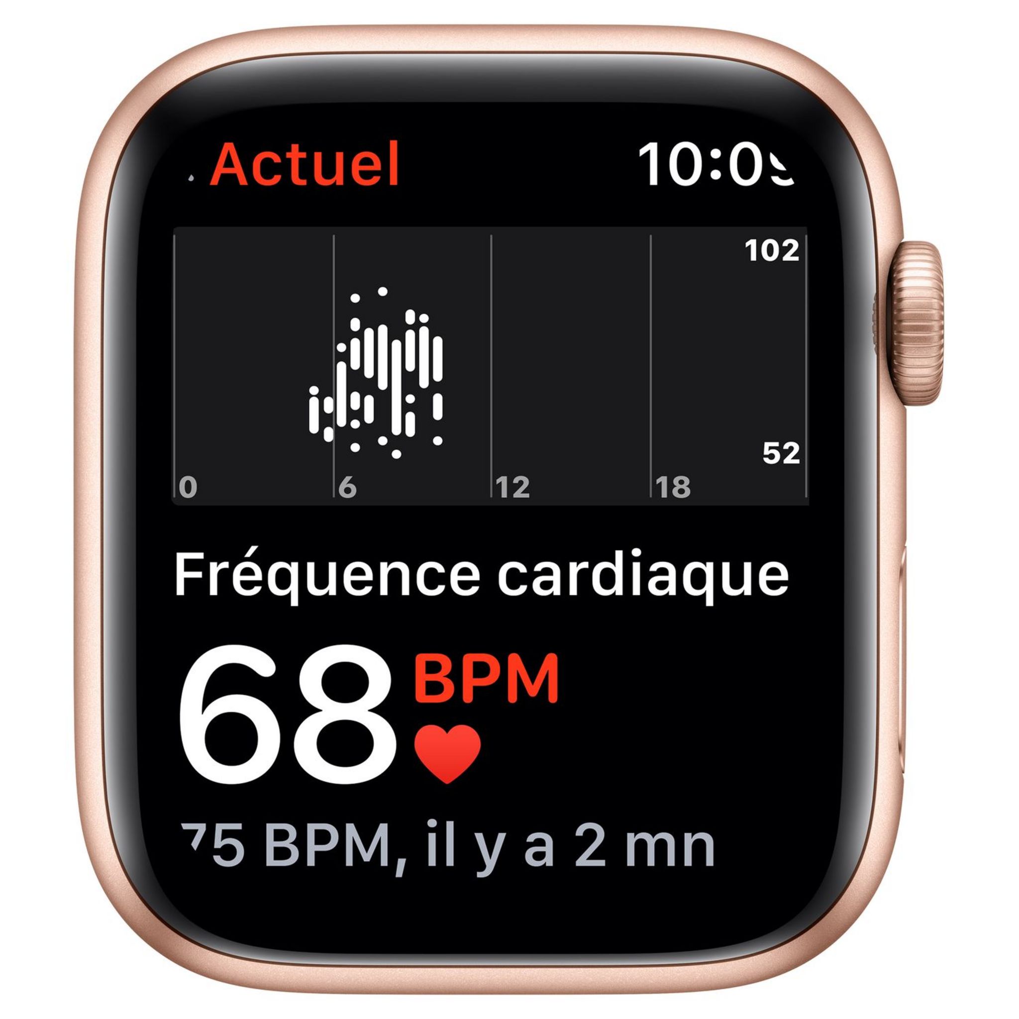 Voir la diapositive 2 : APPLE Montre connectée Apple Watch SE 44MM Alu Or/Rose