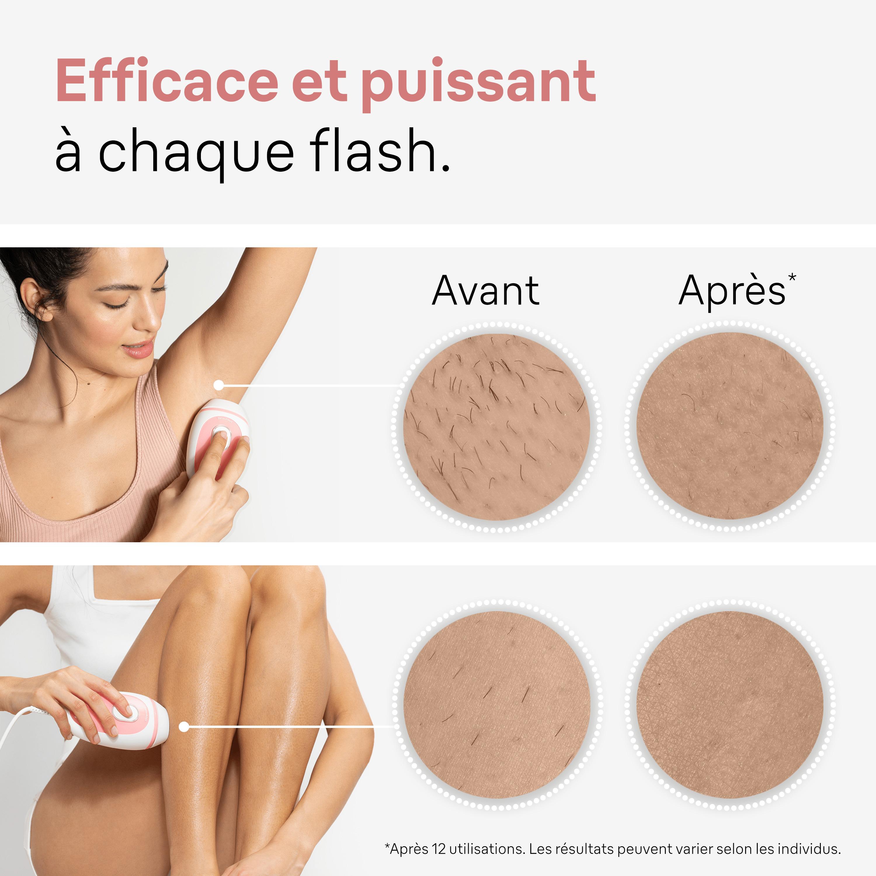 Voir la diapositive 4 : BRAUN Épilateur à la lumière pulsée PL1000 corps et visage - Rose