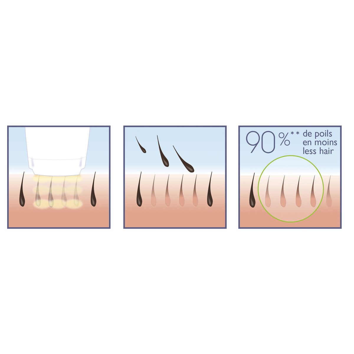 BABYLISS Épilateur à lumière pulsée IPL G960E