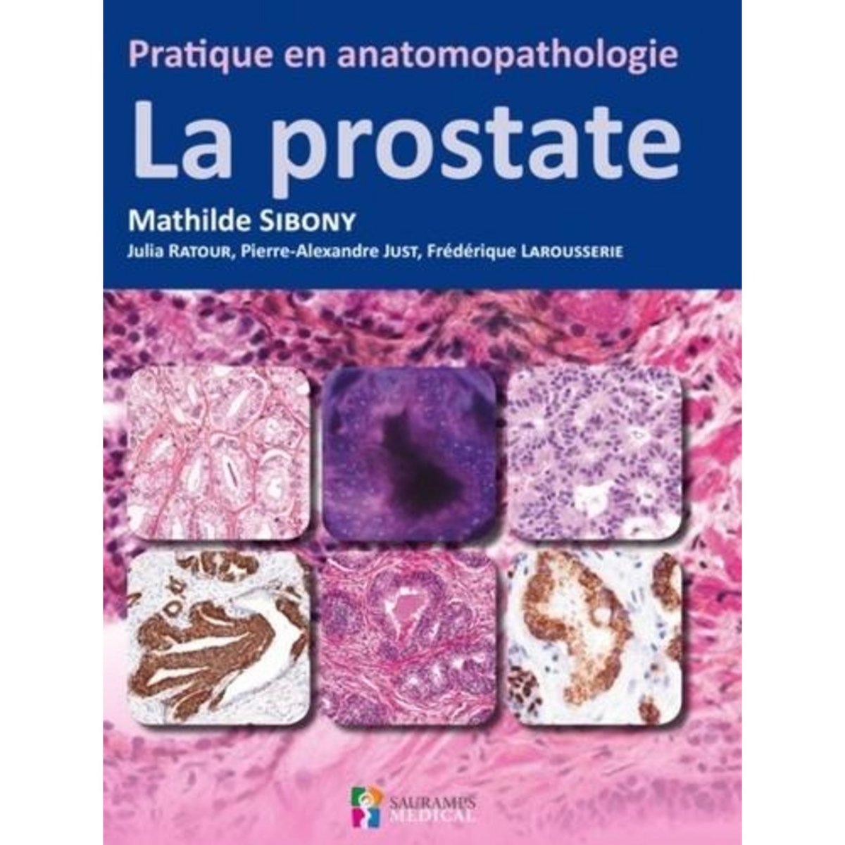 LA PROSTATE, Sibony Mathilde