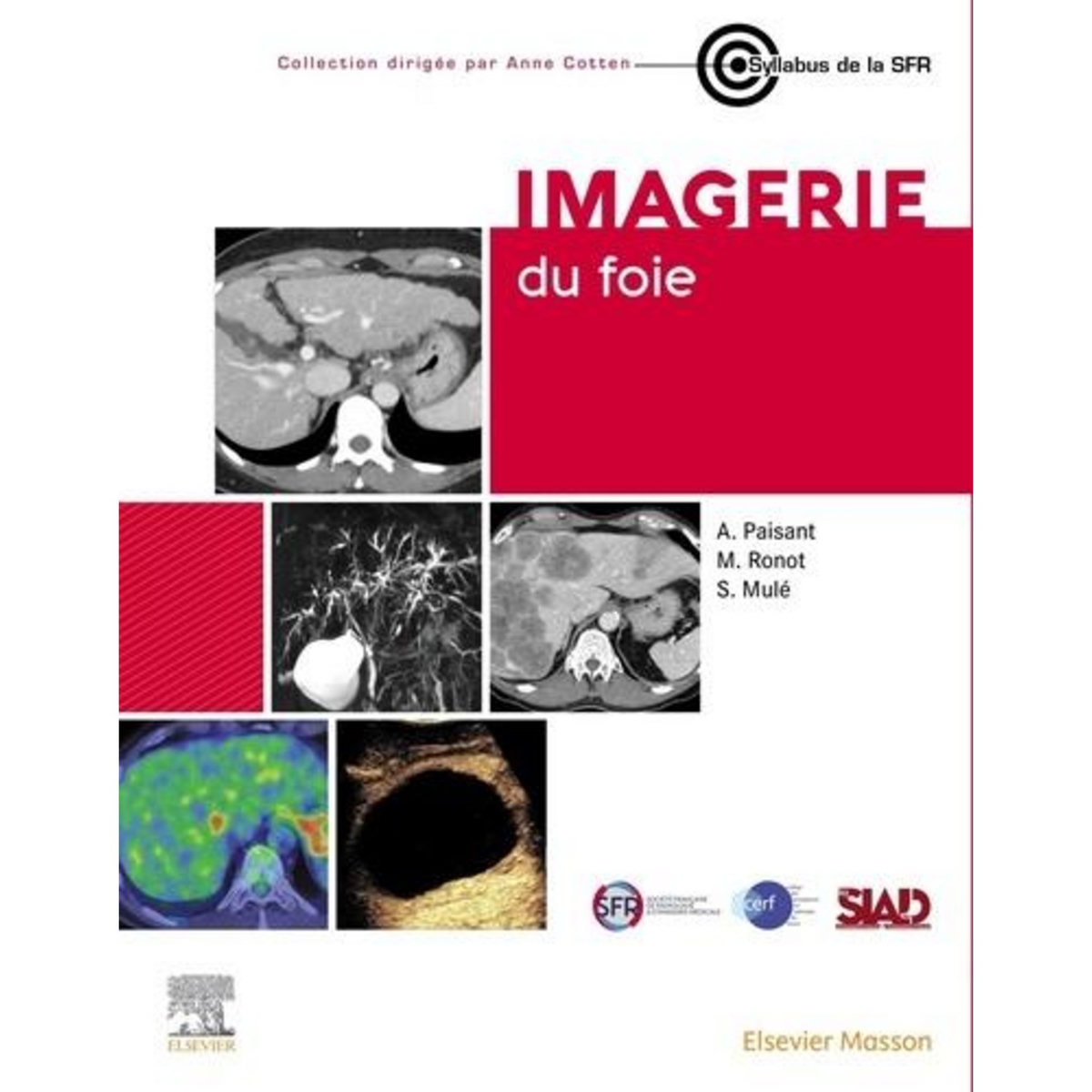 IMAGERIE DU FOIE, Paisant Anita