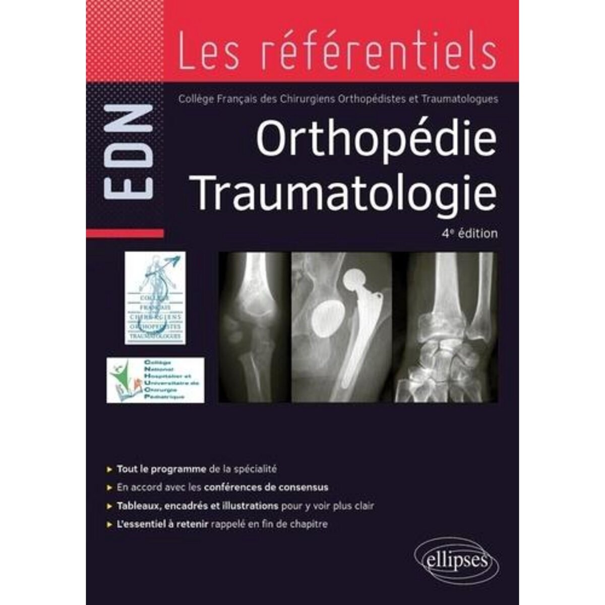ORTHOPEDIE TRAUMATOLOGIE, Collége Français Chirurgie