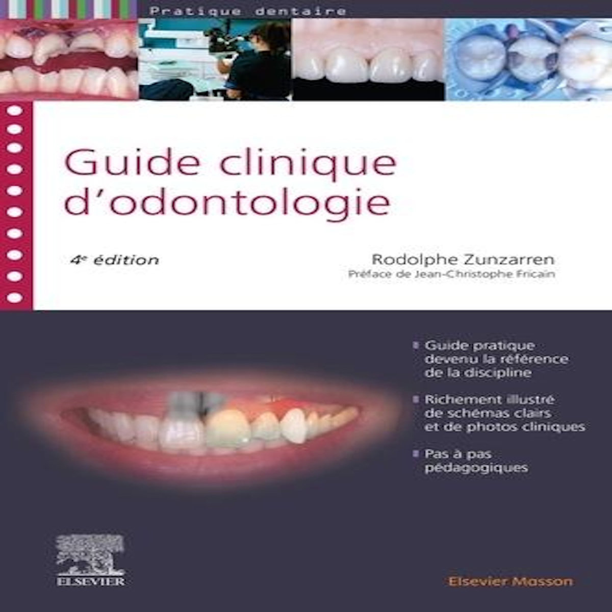 GUIDE CLINIQUE D'ODONTOLOGIE. 4E EDITION, Zunzarren Rodolphe