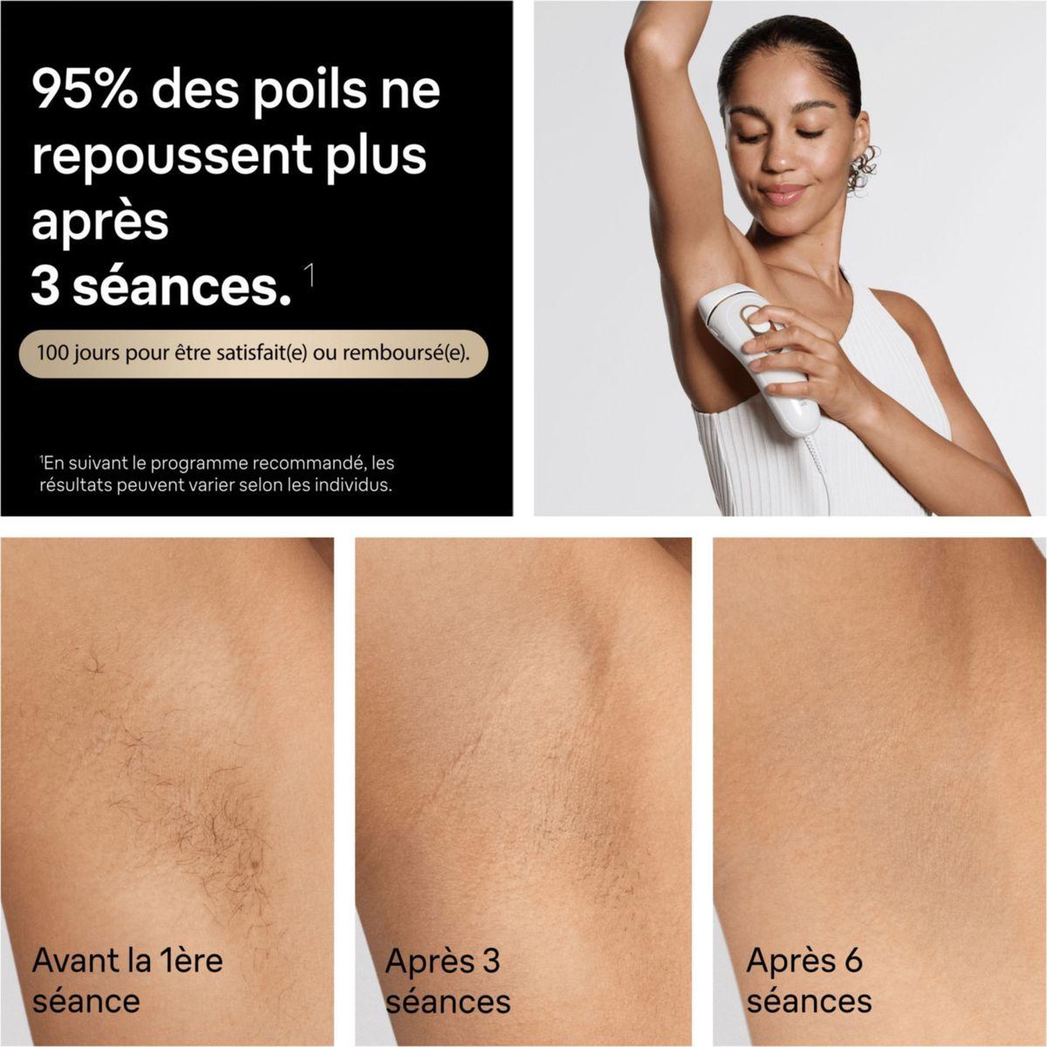 Voir la diapositive 3 : BRAUN Epilateur lumière pulsée IPL PL5234 2 têtes, 1 rasoir Gillette Venus, une pochette