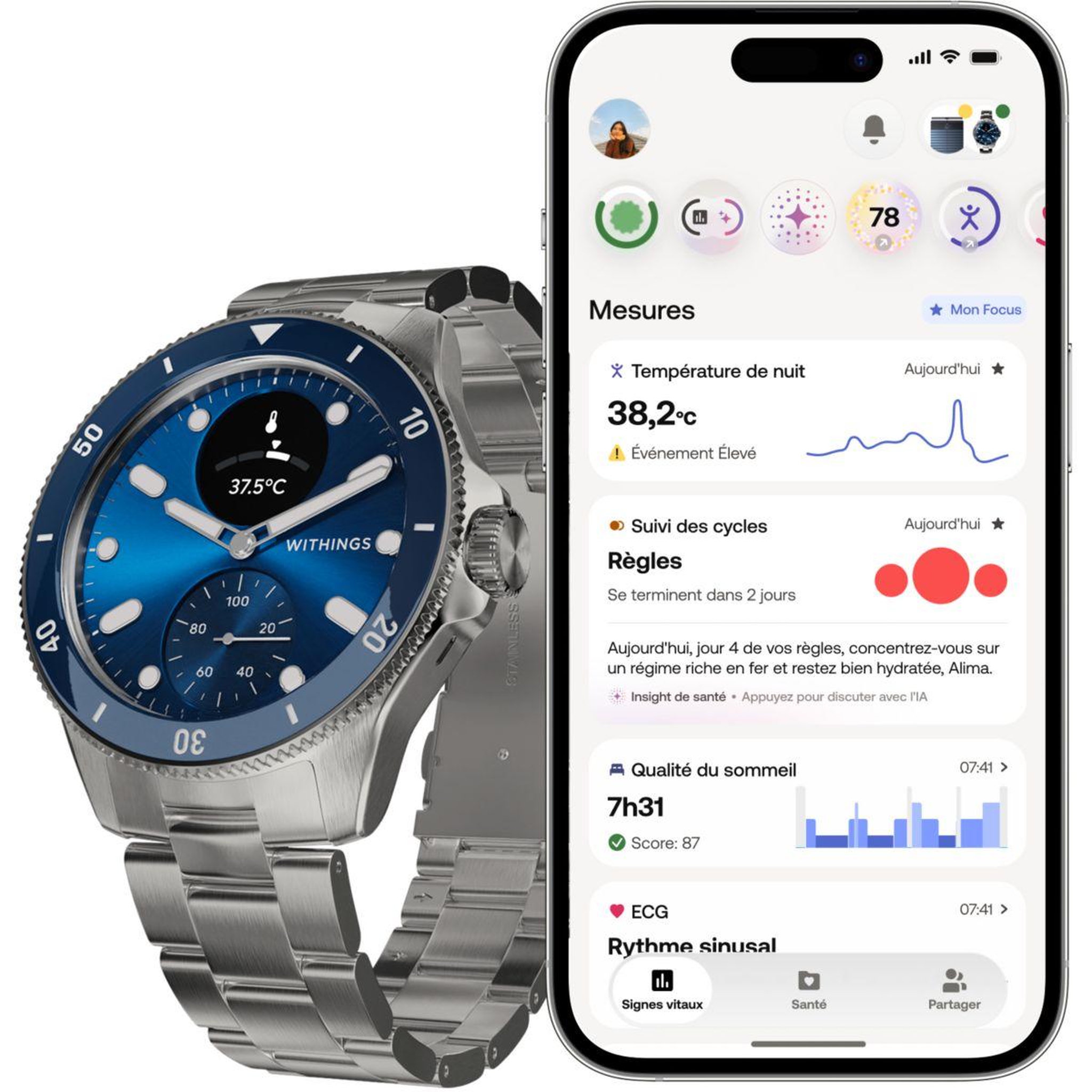 Voir la diapositive 2 : WITHINGS Montre santé scanwatch nova bleue