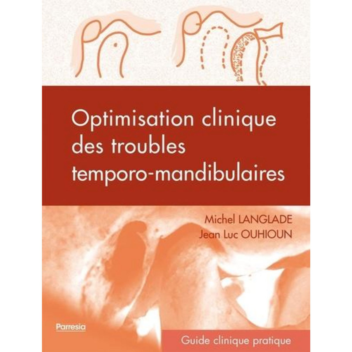 OPTIMISATION CLINIQUE DES TROUBLES TEMPORO-MANDIBULAIRES, Langlade Michel
