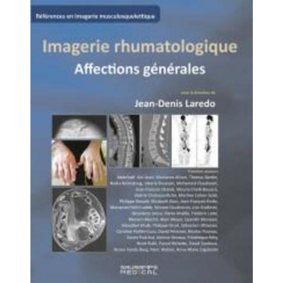 IMAGERIE RHUMATOLOGIQUE. AFFECTIONS GENERALES, Laredo Jean-Denis