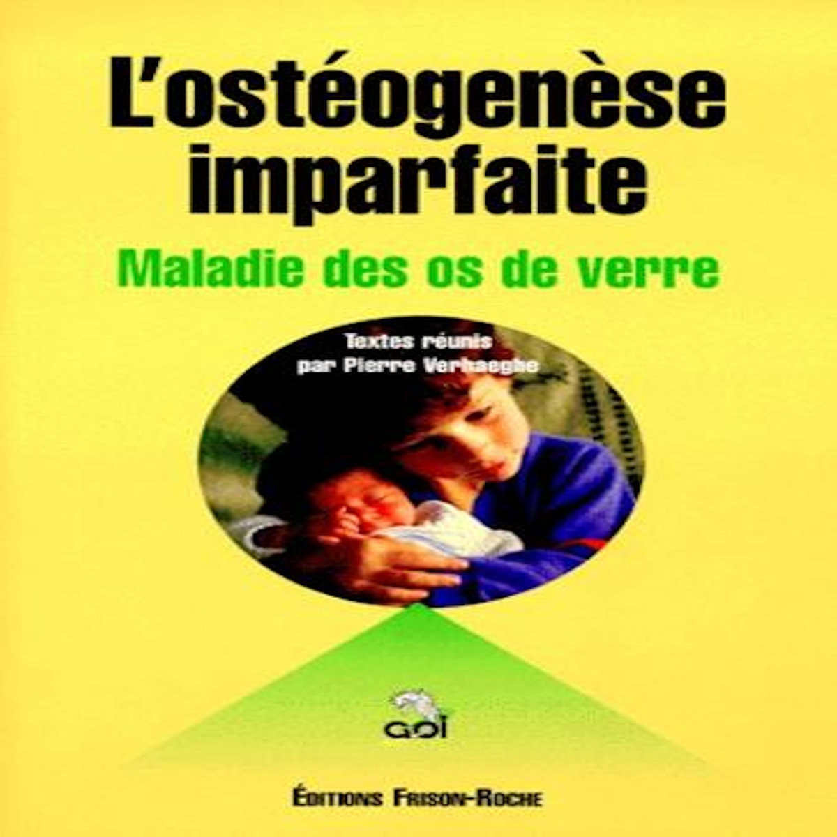 L'OSTEOGENESE IMPARFAITE. 2EME EDITION, -